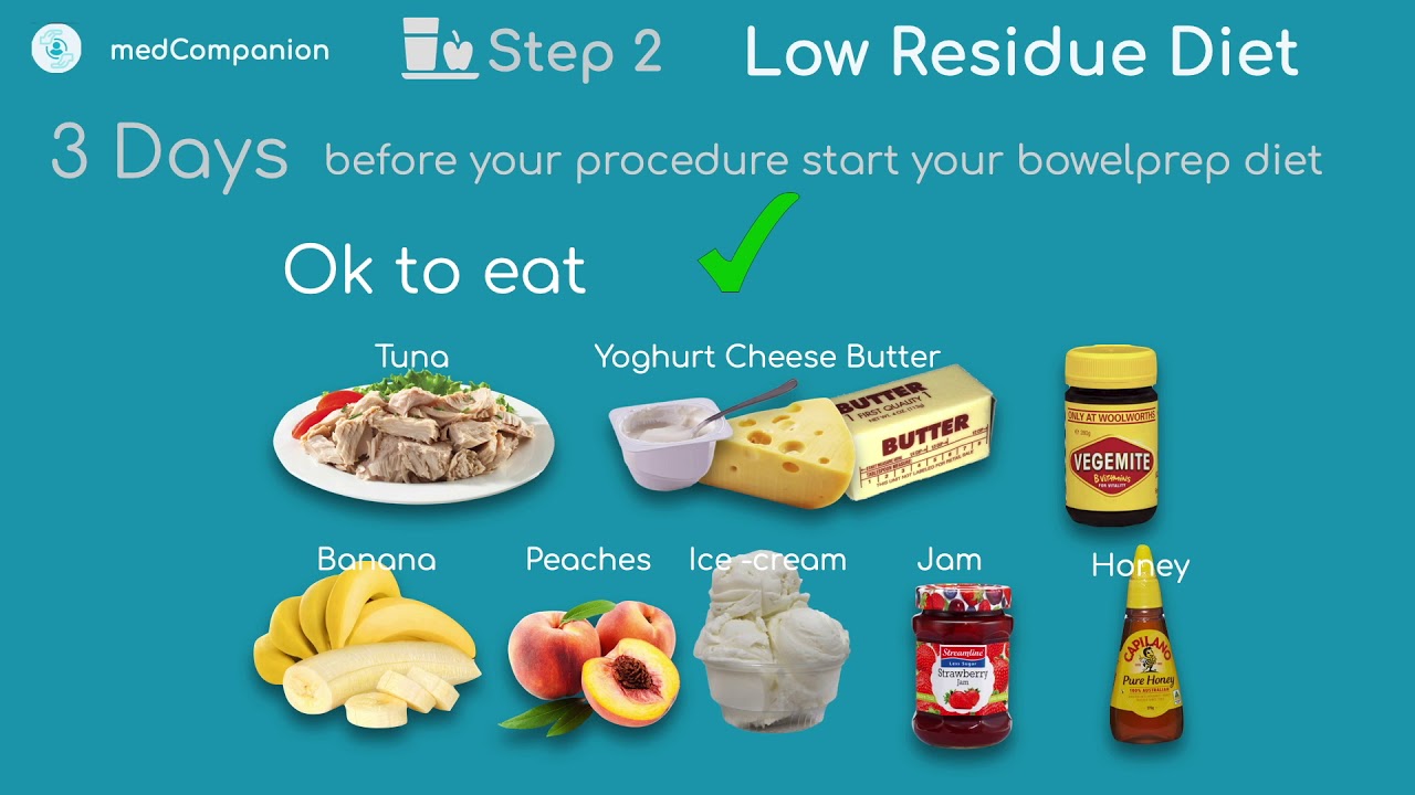 Effective Diet Plan for Irritable Bowel Syndrome in 2025: Discover Solutions