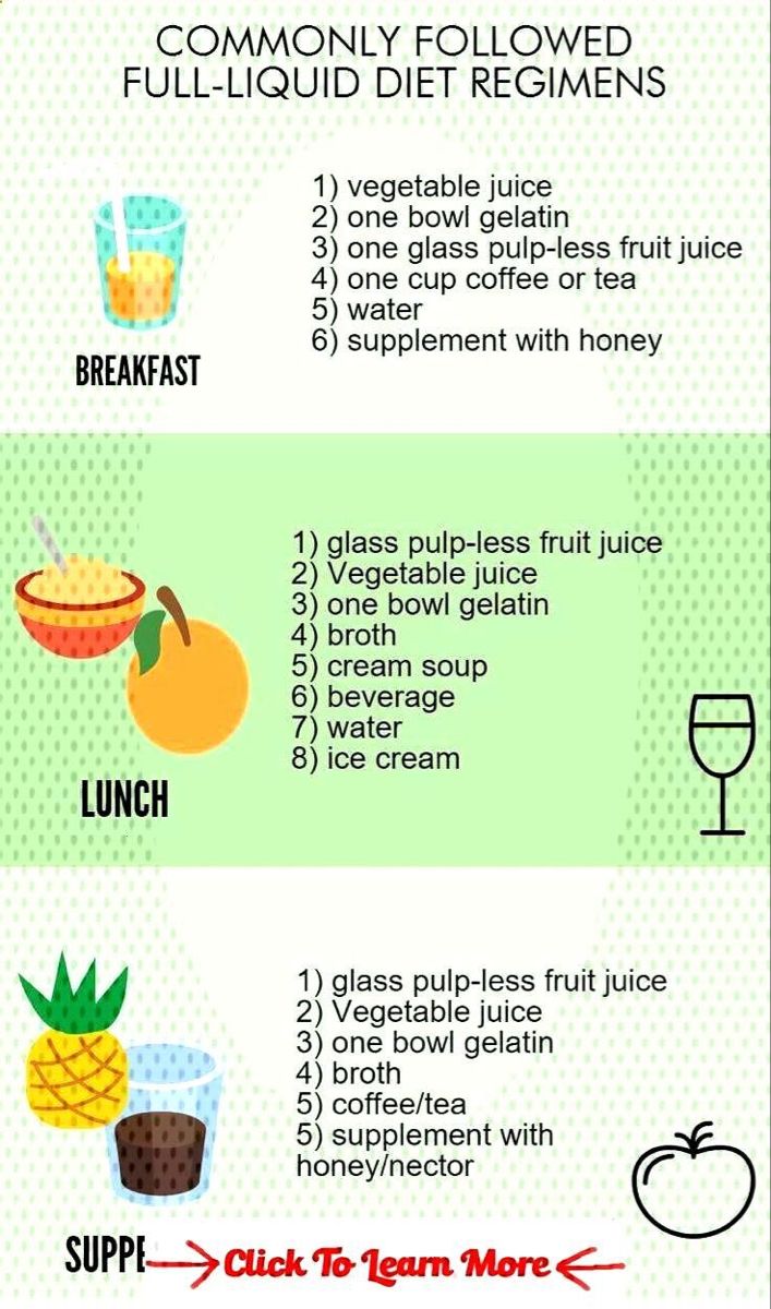 Top 5 Effective Science Diet Kitten Food Options for 2025