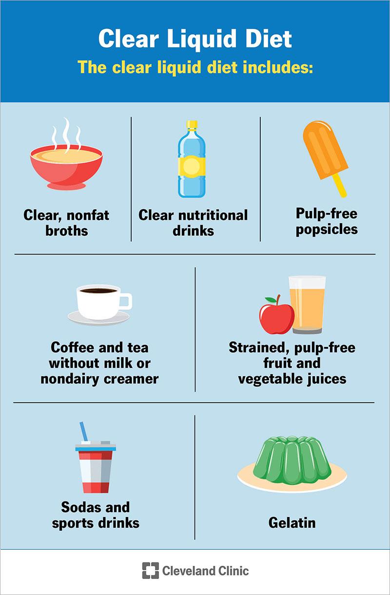 Essential Guide to Clear Liquid Diet Menu for Successful Colonoscopy in 2025