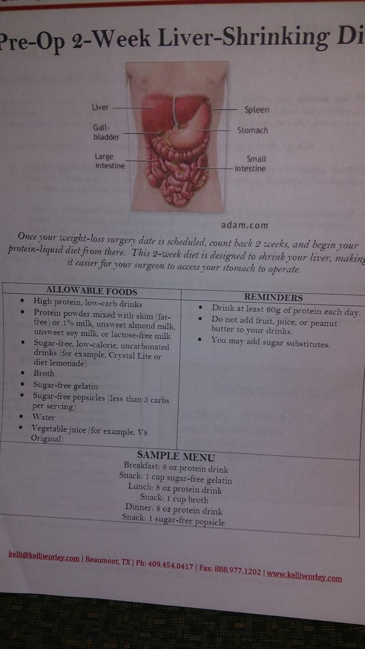 Effective Ways to Manage Your Liver Shrinking Diet for Successful Results in 2025